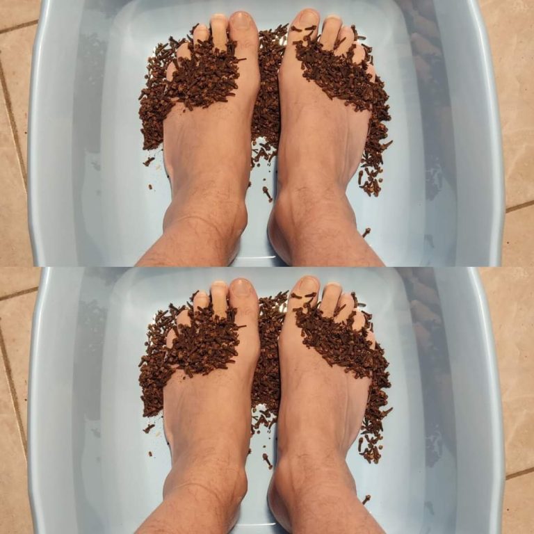 Posmaruj stopy goździkami i jestem zachwycona efektem