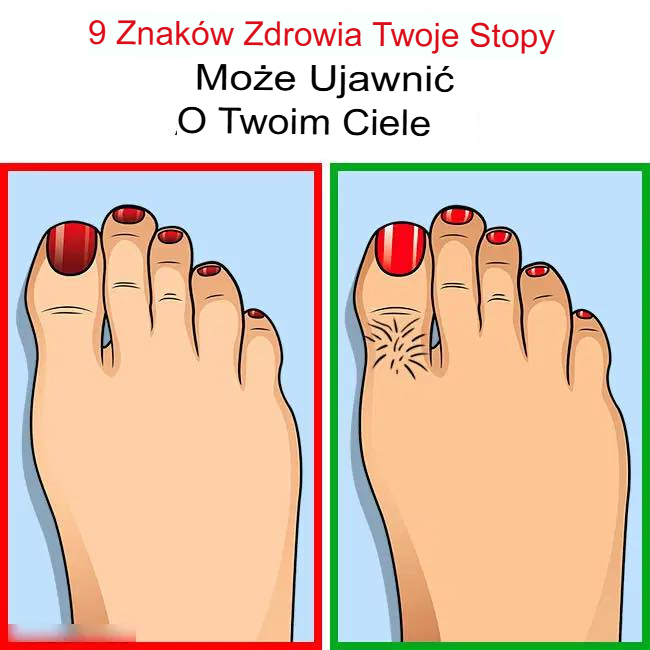 9 Oznak Zdrowotnych, Które Twoje Stopy Mogą Ujawnić o Twoim Ciele