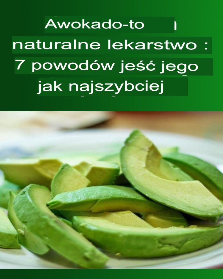 7 powodów, dla których warto jeść awokadoPrzyznaj,