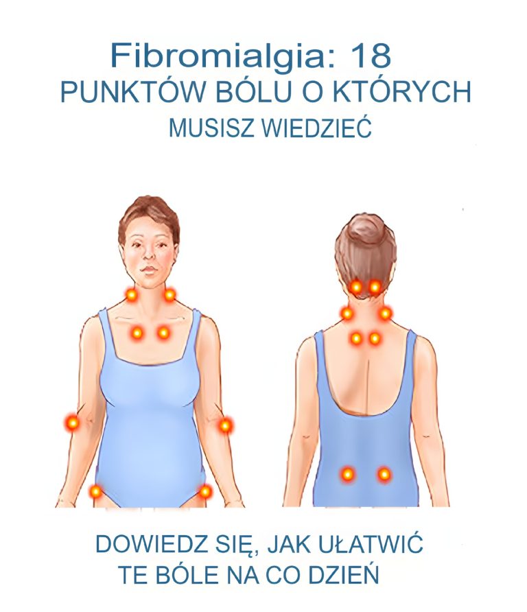 Fibromialgia – co to za choroba, gdzie boli i jak łagodzić dolegliwości?
