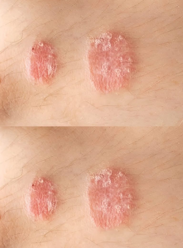 Sygnały ostrzegawcze, których nigdy nie należy ignorować na skórze