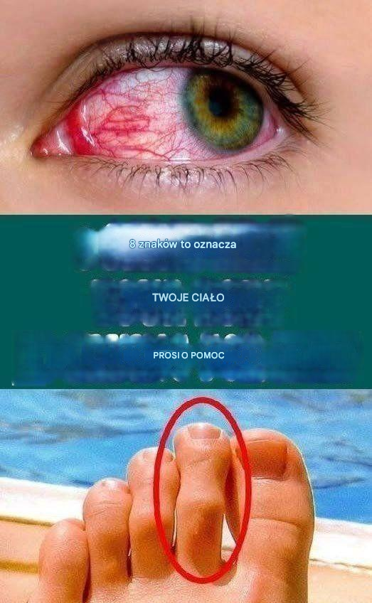 8 oznak, że twoje ciało prosi o pomoc