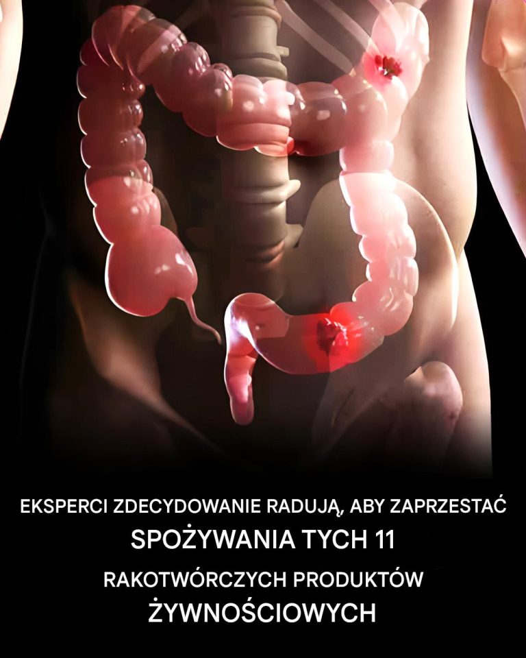 11 produktów spożywczych, które wydają się nieszkodliwe, ale eksperci zalecają, aby przestać je jeść