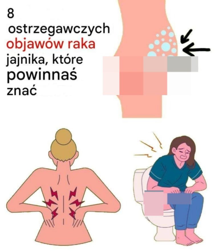 8 ostrzegawczych objawów raka jajnika, których nie należy ignorować