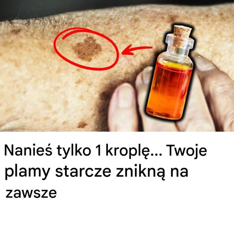 Nanieś tylko 1 kroplę… Twoje plamy starcze znikną na zawsze