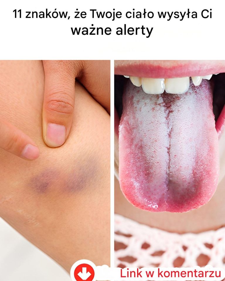 11 znaków, że Twoje ciało wysyła Ci ważne alerty