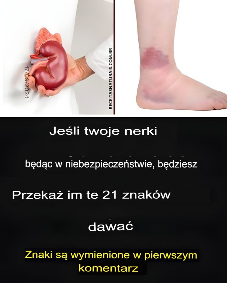 Jak dbać o nerki – leczenie, domowe sposoby i objawy chorób nerek