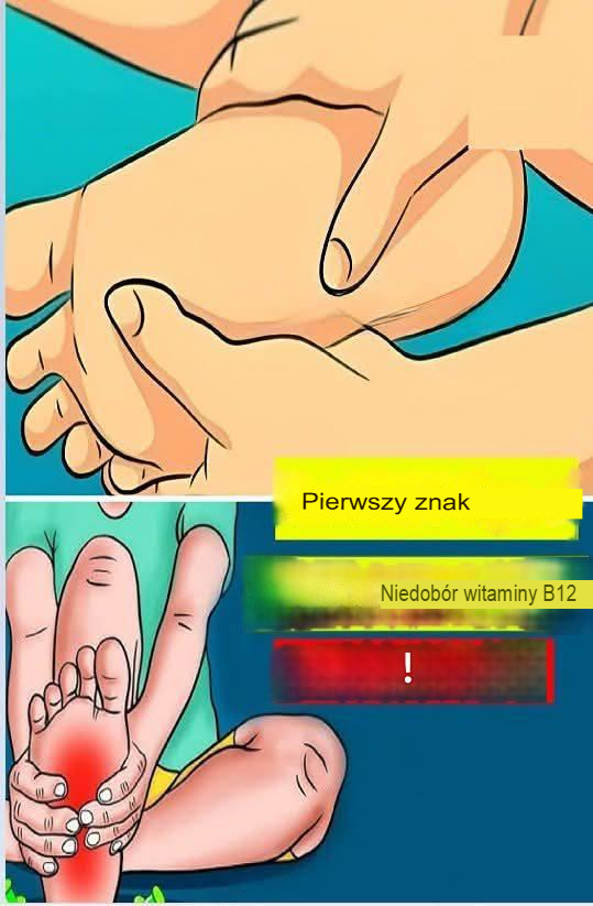 9 objawów niedoboru witaminy B12!!!