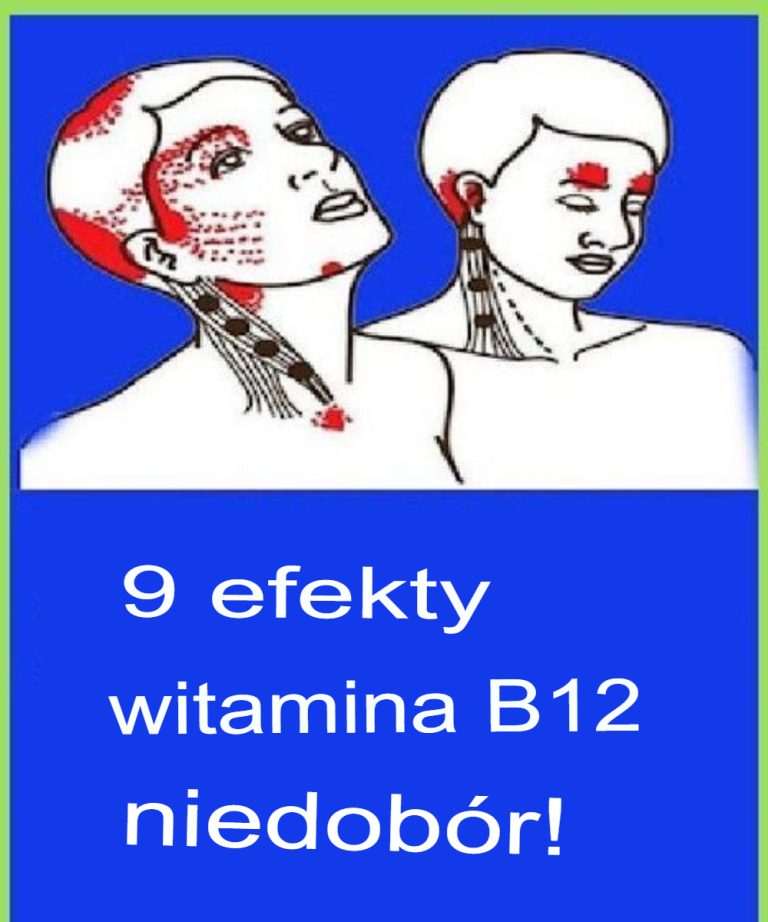 9 objawów niedoboru witaminy B12