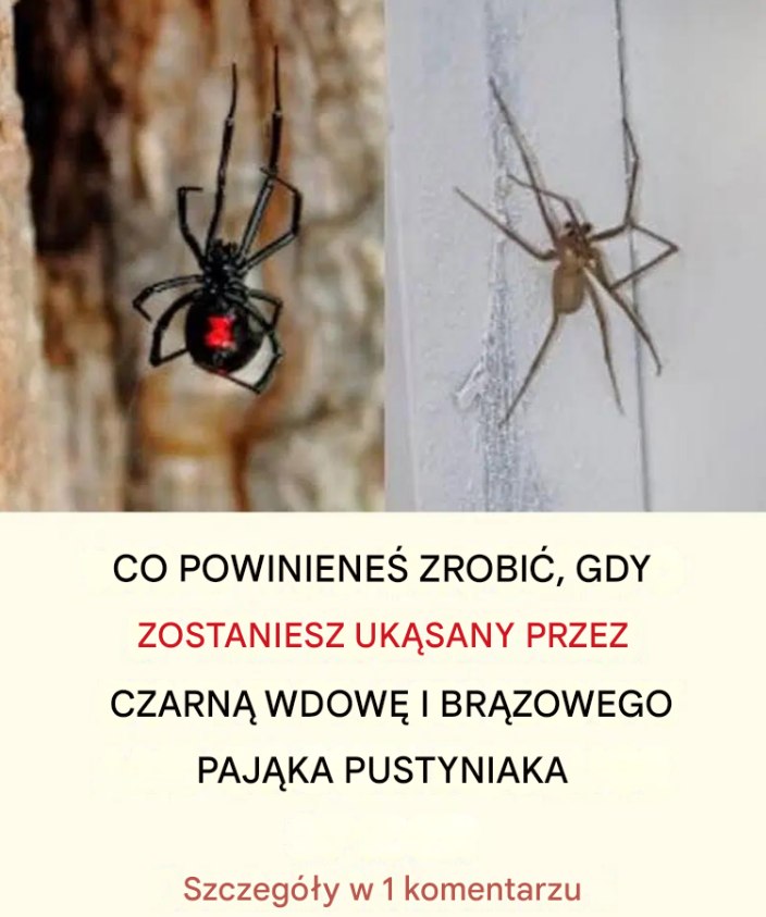 Co zrobić, jeśli ukąsi cię czarna wdowa: kompletny przewodnik