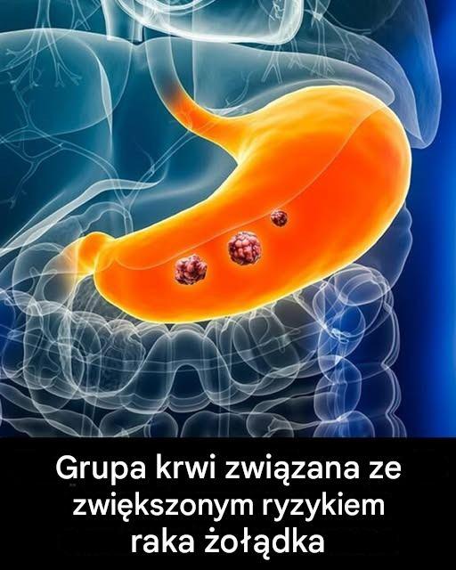 Grupa Krwi a Rak Żołądka – Co Mówią Najnowsze Badania Medyczne?