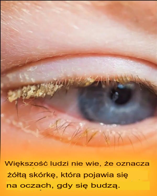 Żółta skorupa po przebudzeniu: co to oznacza?