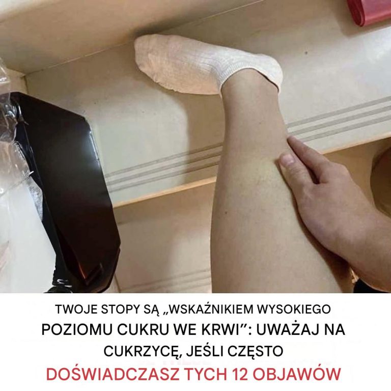 12 objawów hipoglikemii, które należy rozpoznać