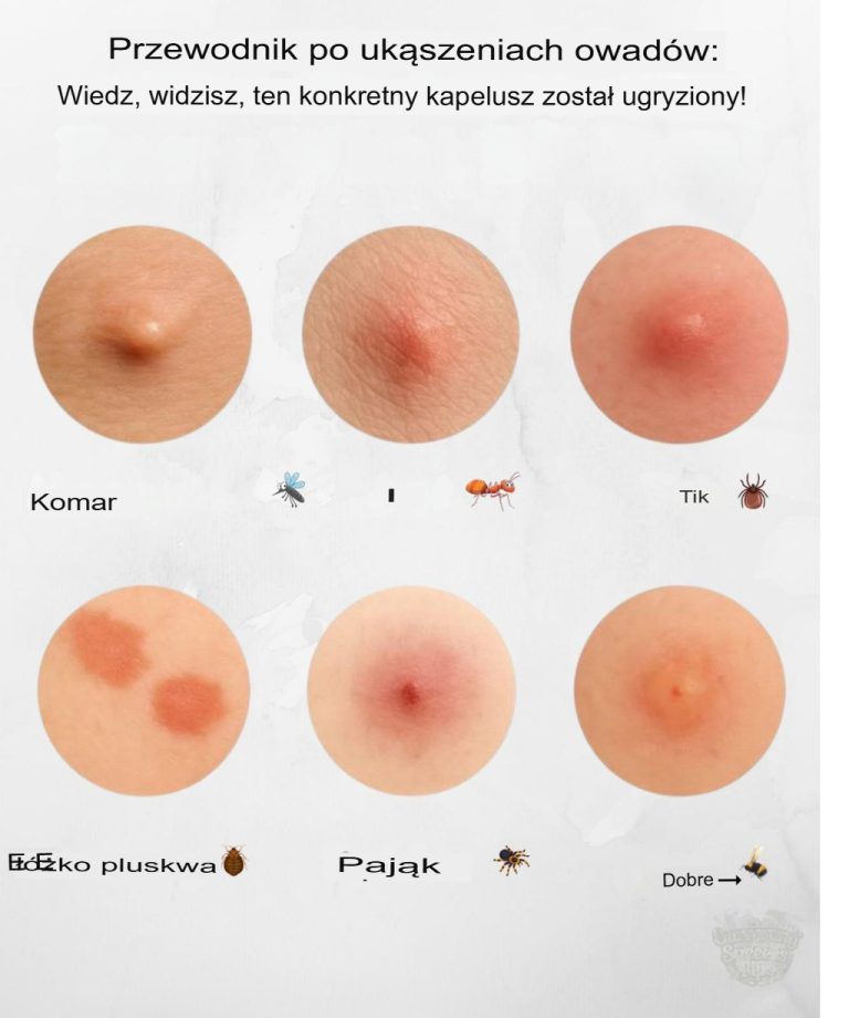 Rozpoznawanie ukąszeń: Jak rozpoznać typowe ukąszenia owadów