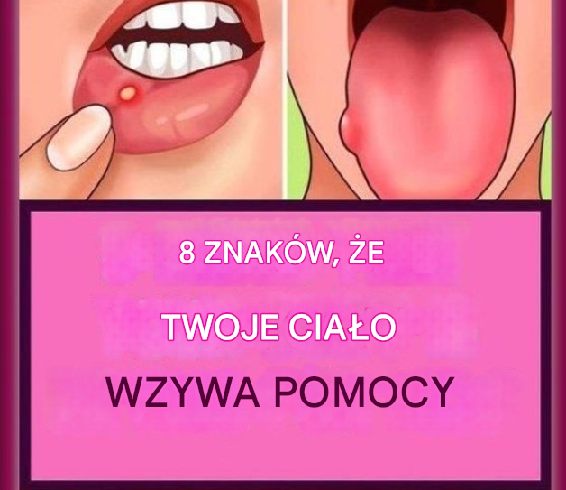 8 oznak, że Twoje ciało potrzebuje pomocy