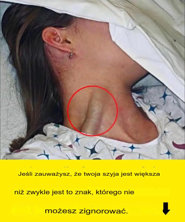 Jeśli zauważysz, że Twoja szyja jest grubsza niż zwykle, to znak, którego nie możesz ignorować.