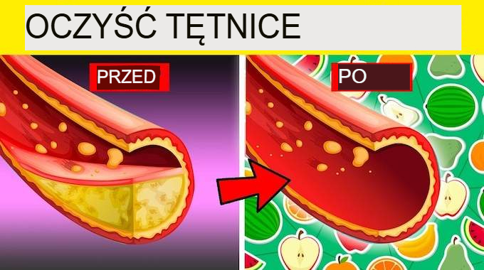 13 domowych sposobów na naturalne oczyszczenie tętnic.