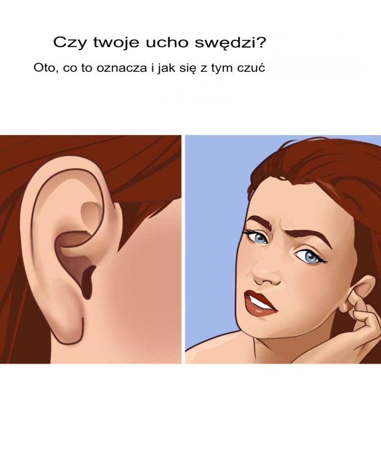 Moje swędzą cały czas! Musiałem to zobaczyć!