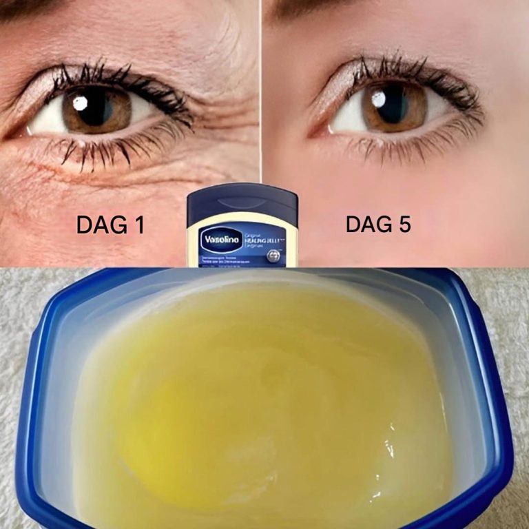 Niespodziewana moc wazeliny w usuwaniu zmarszczek: naturalnie odmłodź swoją skórę o 20 lat!