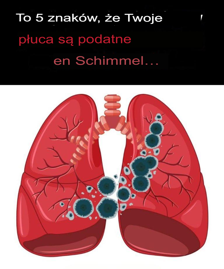 5 oznak, że Twoje płuca są narażone na pleśń