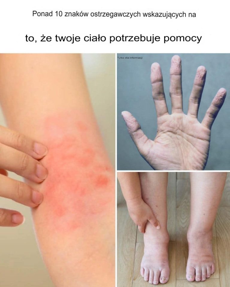 10+ alarmujących znaków, że twoje ciało potrzebuje pomocy