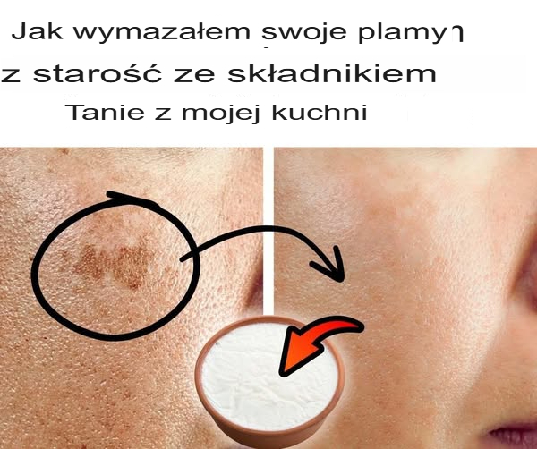 Jak pozbyłam się plam starczych za pomocą taniego składnika z mojej kuchni