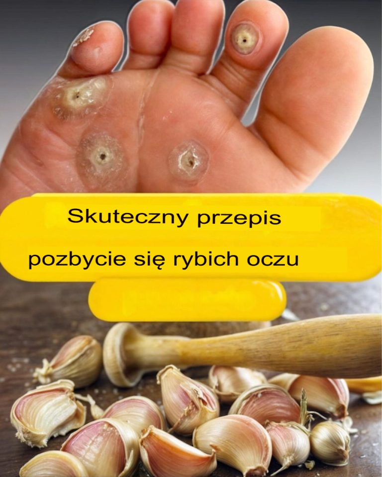 Pozbądź się rybich oczu dzięki tym skutecznym, naturalnym środkom na bazie czosnku