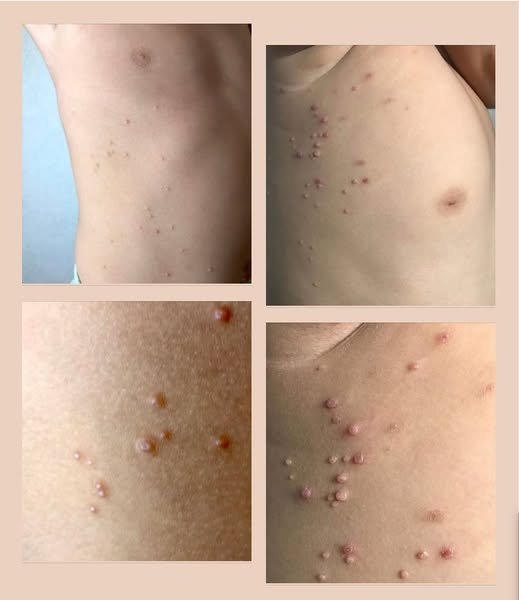 Jeśli coś takiego zdarzy się w Twoim ciele, zachowaj czujność: może to być znak ostrzegawczy