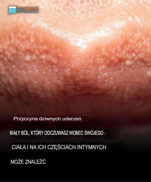 Przyczyna dziwnych białych pryszczy na ciele