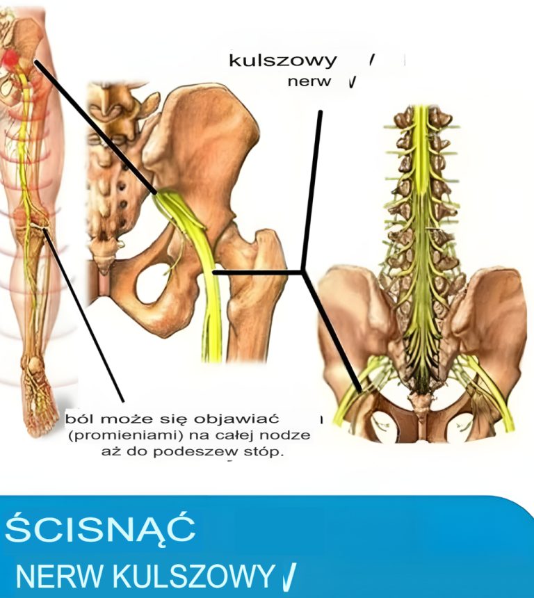 Nerw kulszowy jest jednym z najdłuższych i najważniejszych nerwów w naszym ciele. Zaczyna się u podstawy kręgosłupa i biegnie w dół do bioder, kolan i pięt. Niektóre gałęzie sięgają nawet do palców… 🤽‍♂🤽‍♀