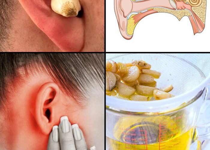Czosnek dla zdrowych uszu: naturalna ulga i ochrona