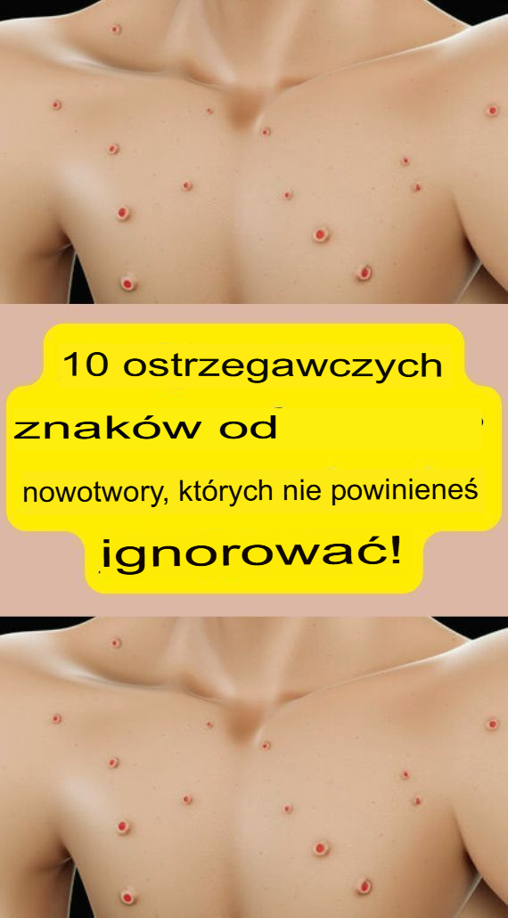 10 ostrzegawczych objawów raka, których nie należy ignorować!