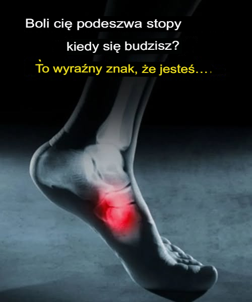 Ból w podeszwie stopy po przebudzeniu? Uważaj na ten możliwy objaw niebezpiecznej choroby!
