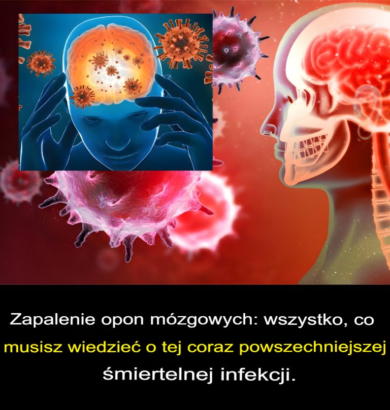 Zapalenie opon mózgowych: wszystko, co musisz wiedzieć o tej śmiertelnej infekcji, która staje się coraz powszechniejsza we Francji
