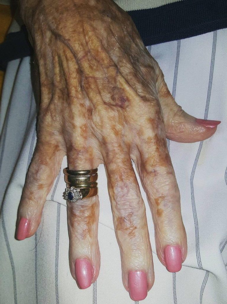 Pielęgniarka zrobiła zdjęcie dłoni starszej kobiety, a następnie odkryła na zdjęciu szczegół, który stał się viralem w internecie