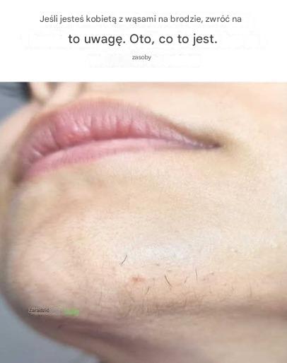 Co Twoje wąsy mówią o Twoim zdrowiu?