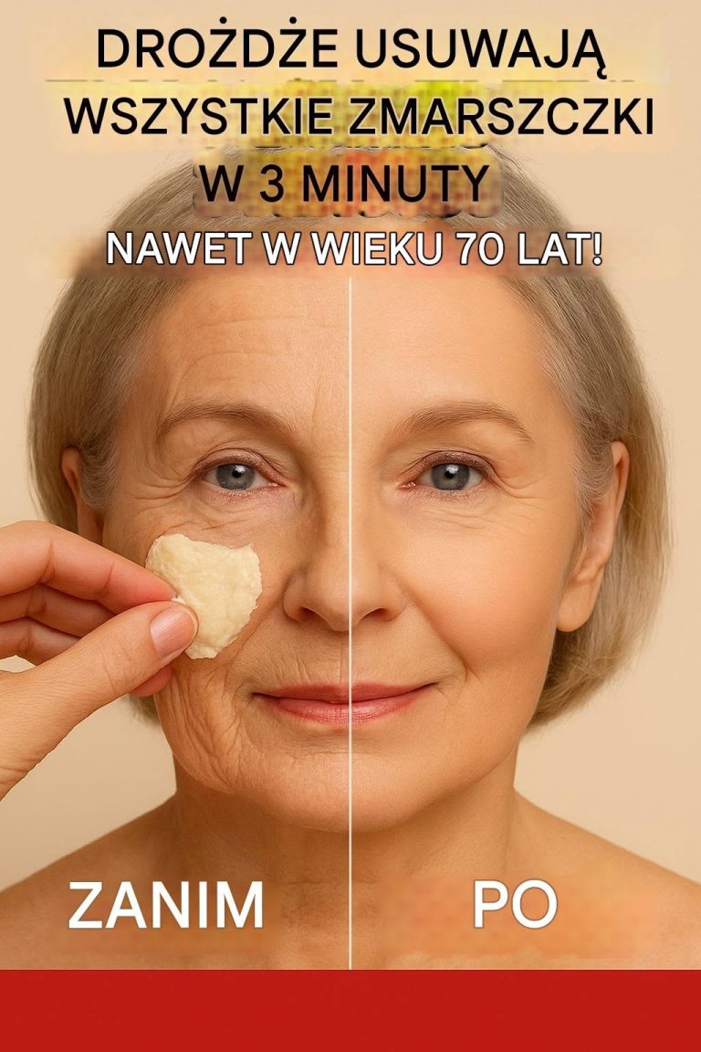 Drożdże usuwają wszystkie zmarszczki w 3 minuty. nawet w wieku 70 lat usuwanie zmarszczek