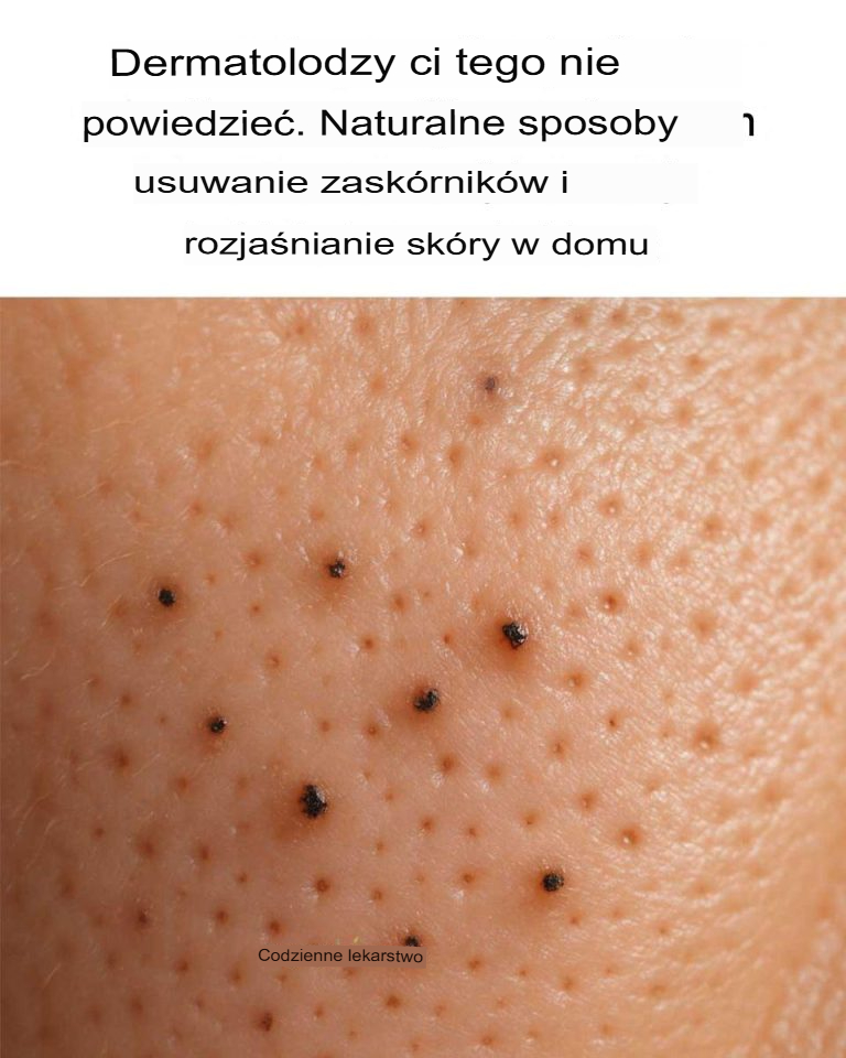 Dermatolodzy ci tego nie powiedzą