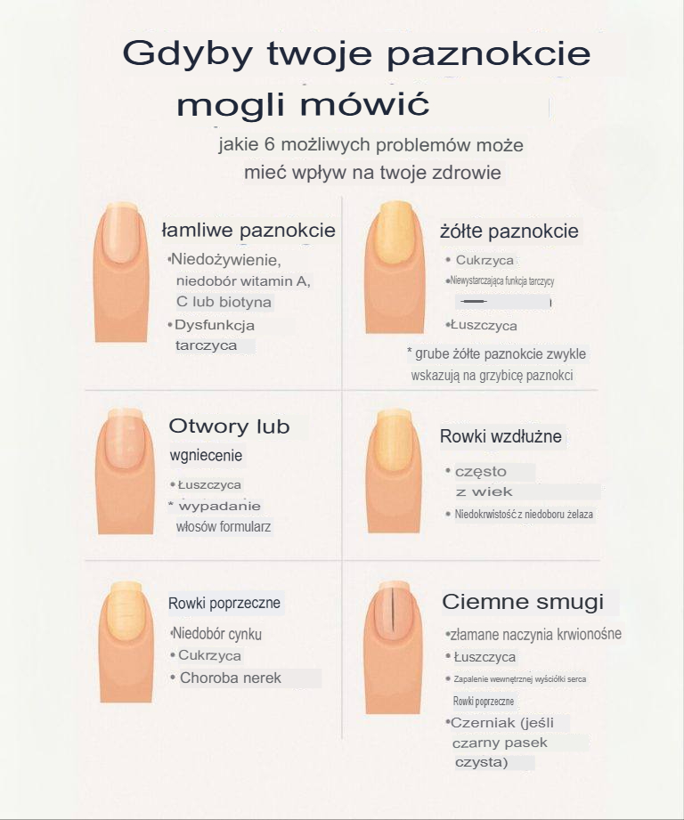 „Twoje paznokcie zdradzają stan Twojego zdrowia – 6 ostrzegawczych sygnałów, które powinnaś znać!”