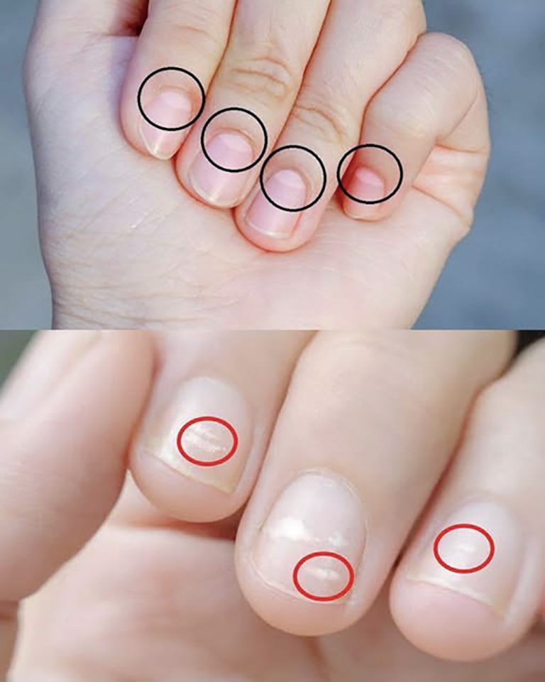 Le mezze lune sulle unghie rivelano il nostro stato di salute