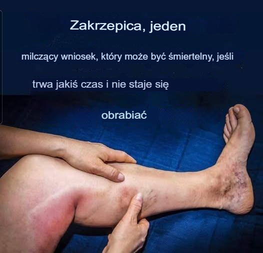 6 najlepszych naparów dla zdrowych tętnic