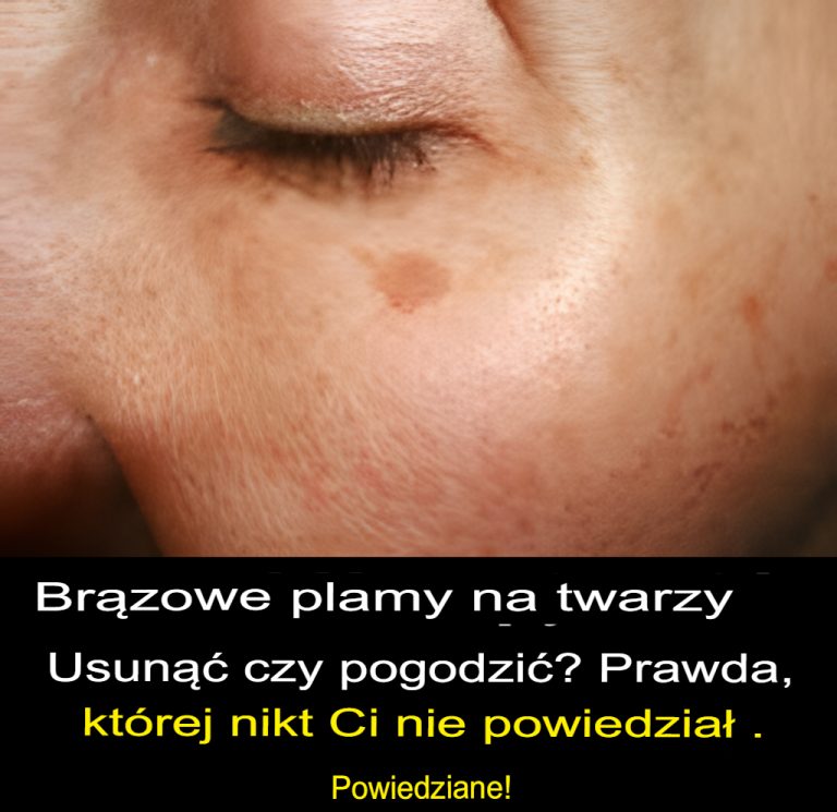 Usuwanie brązowych plam z twarzy – czy to właściwy wybór?