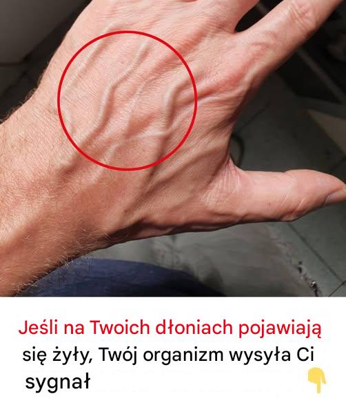 Kiedy nagłe pojawienie się żył powinno zaniepokoić?