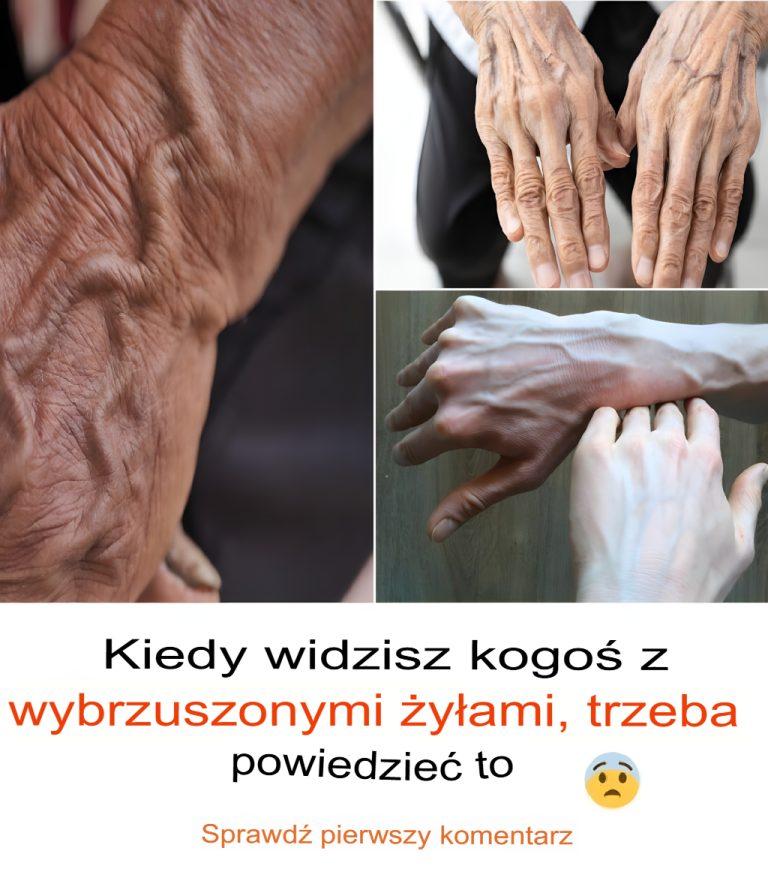 Jeżeli widzisz kogoś z wypukłymi żyłami, powinieneś powiedzieć mu/jej o następujących kwestiach: