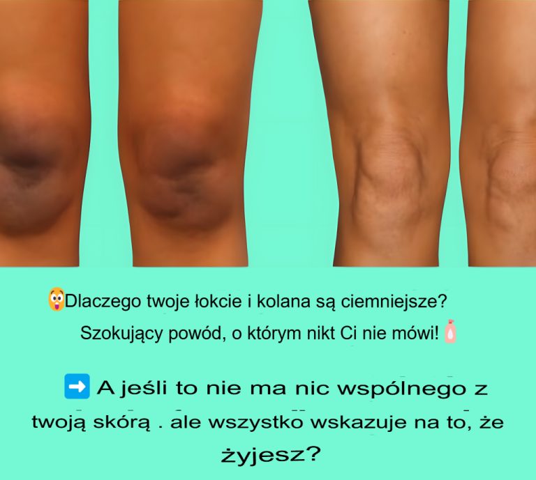 jak pozbyć się czerwonych łokci i kolan z ciemnych plam