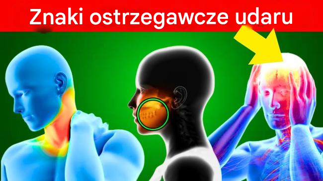 7 objawów udaru mózgu – co musisz wiedzieć!