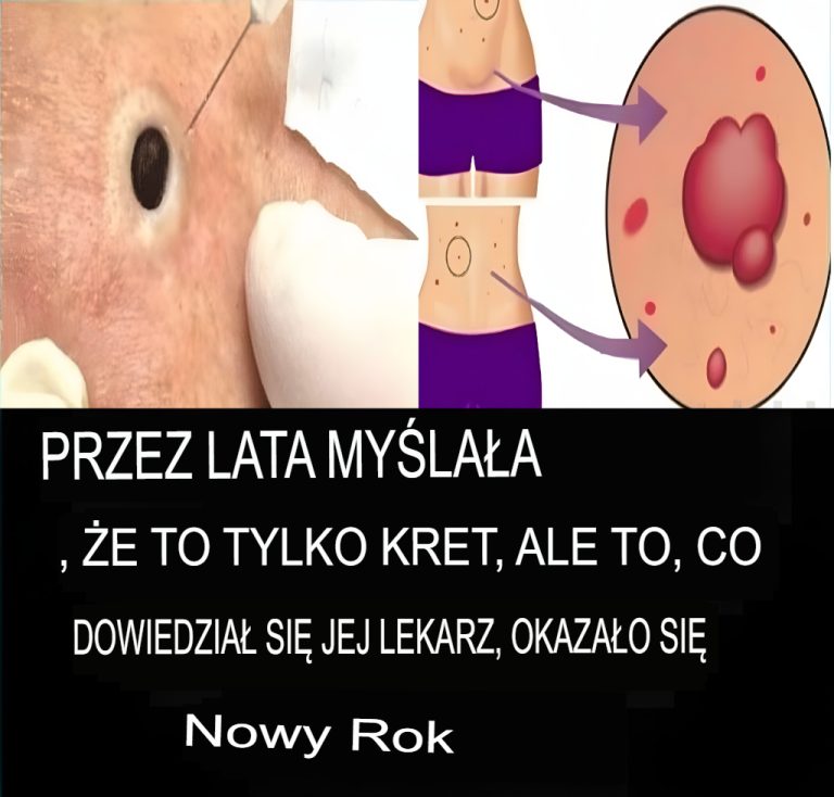 9 ostrzegawczych sygnałów, że w Twoim organizmie rozwija się rak, które kobiety często ignorują!