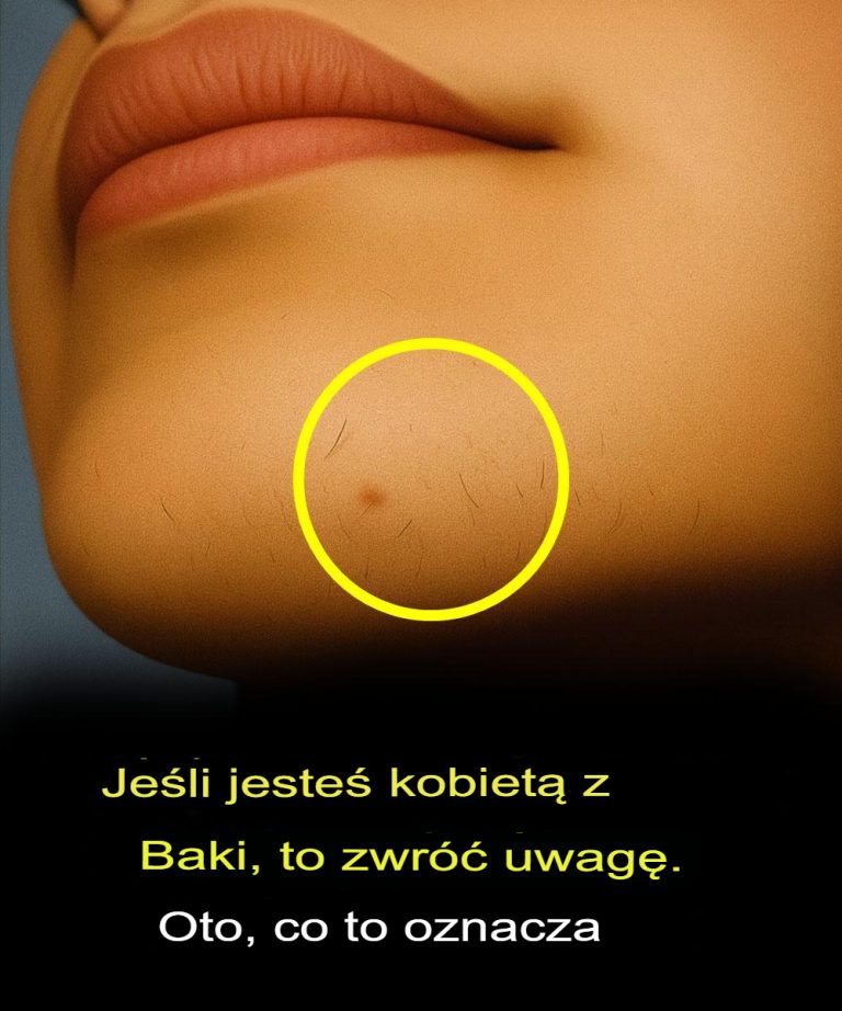 Jeśli jesteś kobietą z wąsami, zwróć uwagę