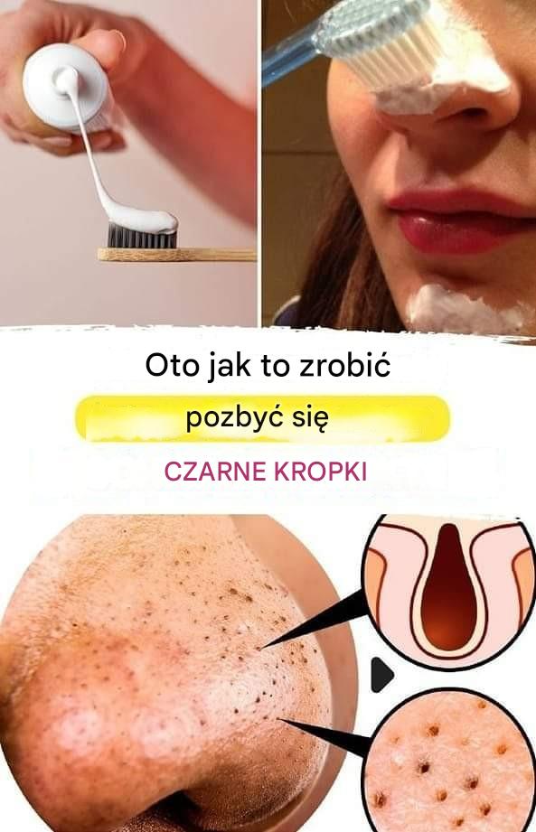 Jak usunąć zaskórniki z twarzy za pomocą szczoteczki do zębów?