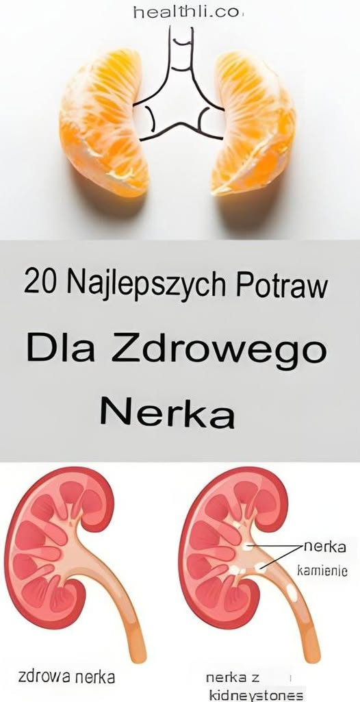 20 najlepszych produktów spożywczych dla zdrowia nerek